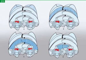 無(wú)油螺桿空壓機(jī)和噴油螺